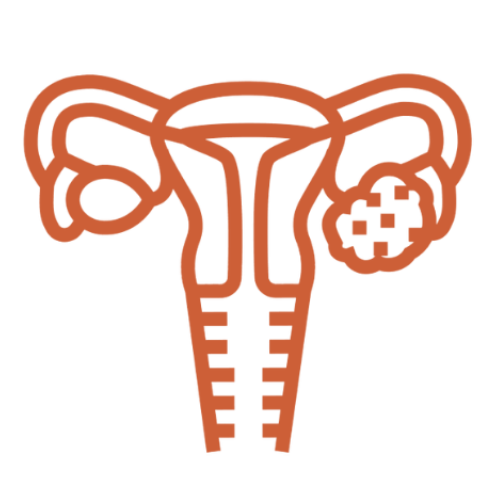PCOD (Polycystic Ovary Disorder)